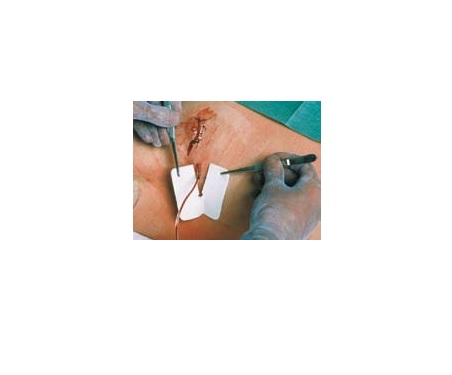 MEDICAZIONE PER TUBI DI DRENAGGIO FESSURATA METALLINE DRAIN 6X7CM FORO 4,5X11MM 50 PEZZI - Farmaciapacini.it